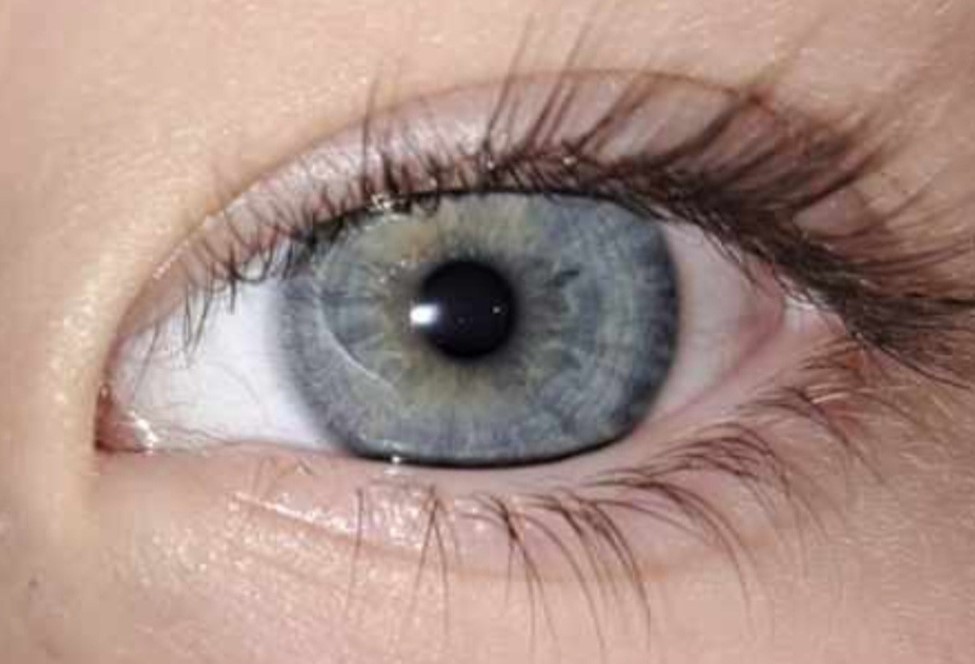 Iridology